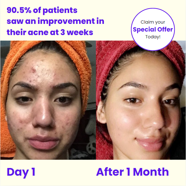 before-after-impact