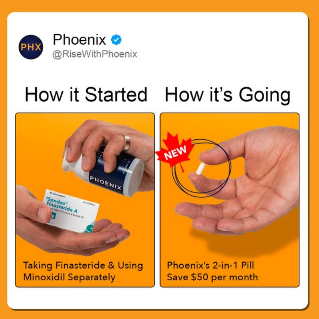 Before & After ad template